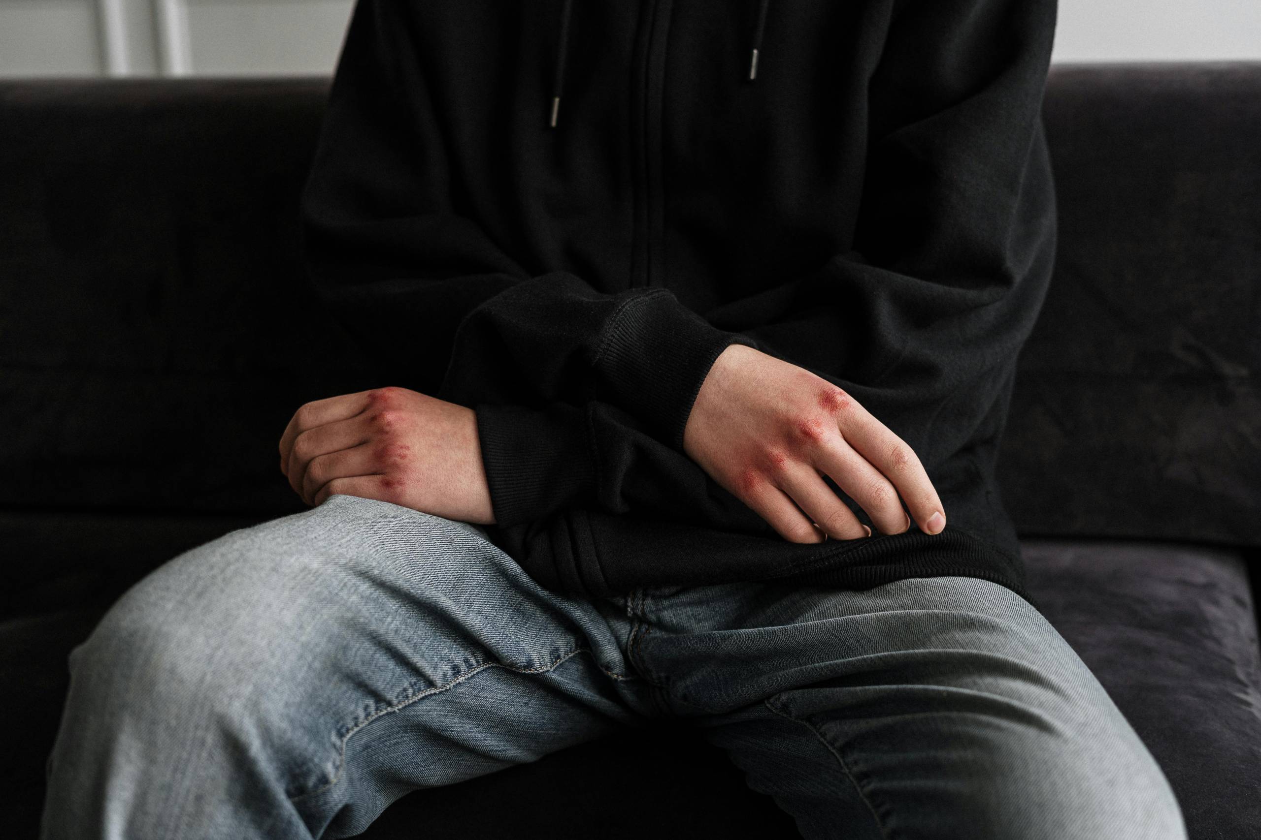 Trauma